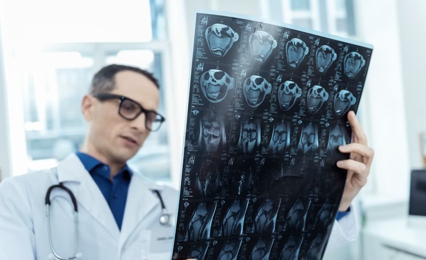 Best Hospitals In Bengaluru For Neurosurgery.jpg